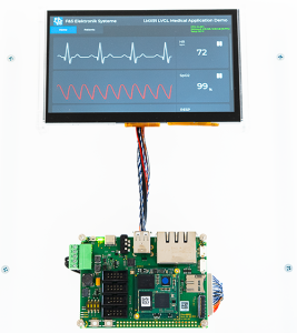 LVGL Medizinanwendung mit NXP i.MX 93